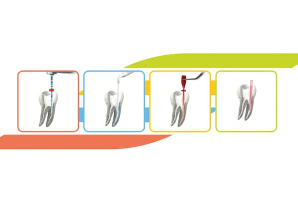 Endo-System_von_VDW_web