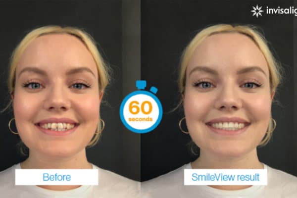 Smileview_Kopie_web