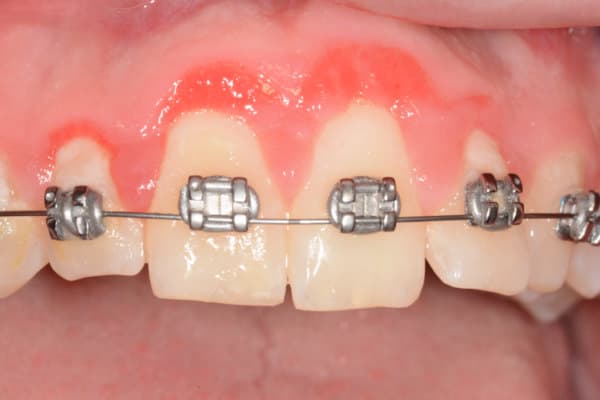 UZB_orale-pathologie_web
