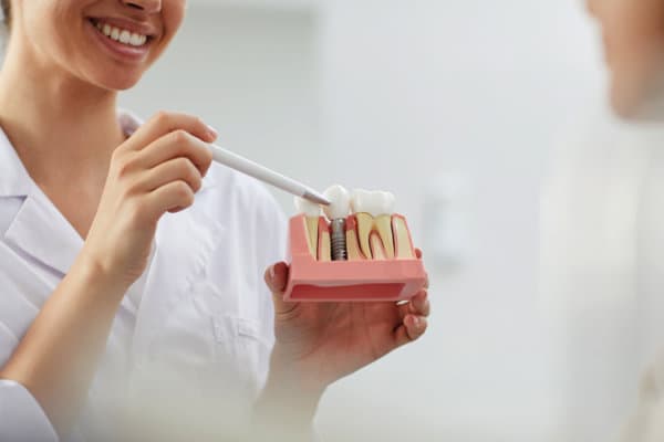 Smiling Dentist Explaining Tooth Implantation