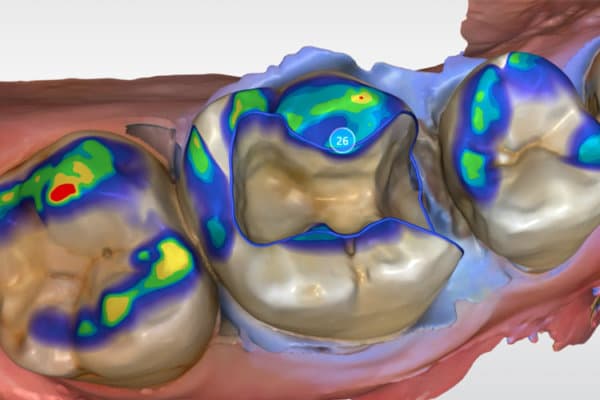 cerec_webinare_web