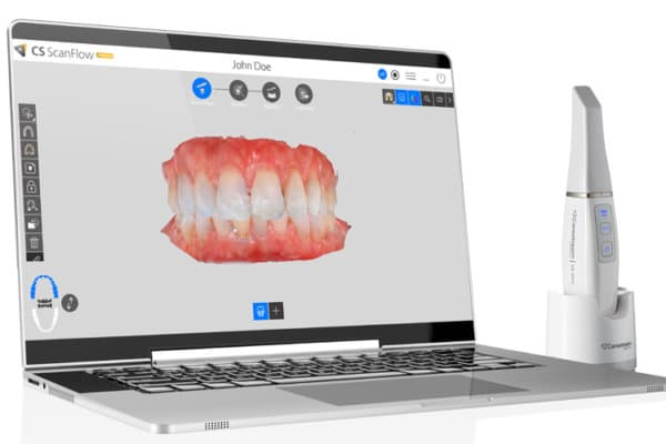 jordi_CS_3800_with_CS_ScanFlow_web