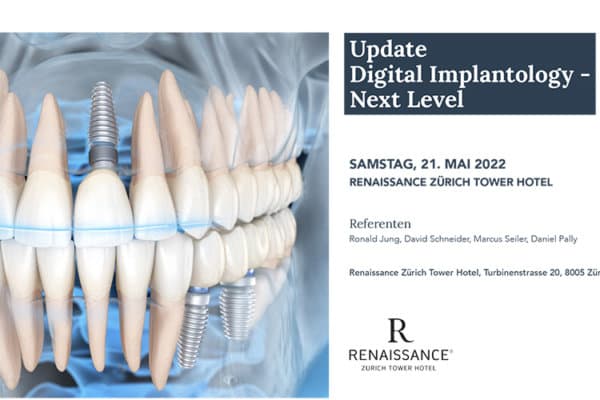 Titelbild_Update_Digital_Implantology_Next_Level