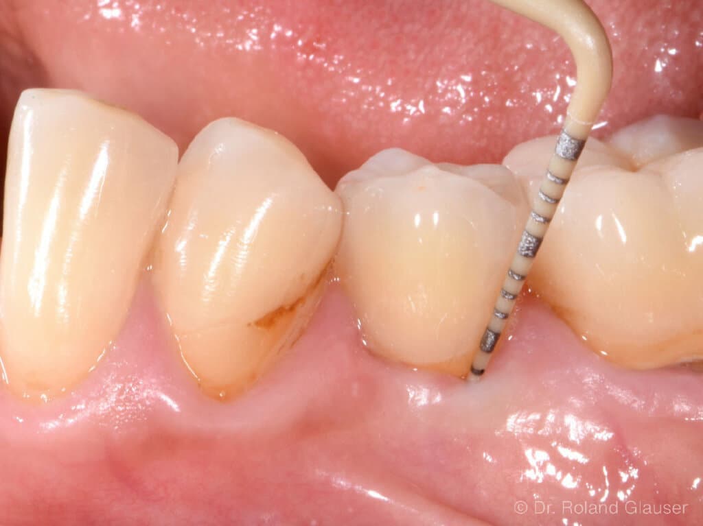 Abb1_Patent_Image20260224100207