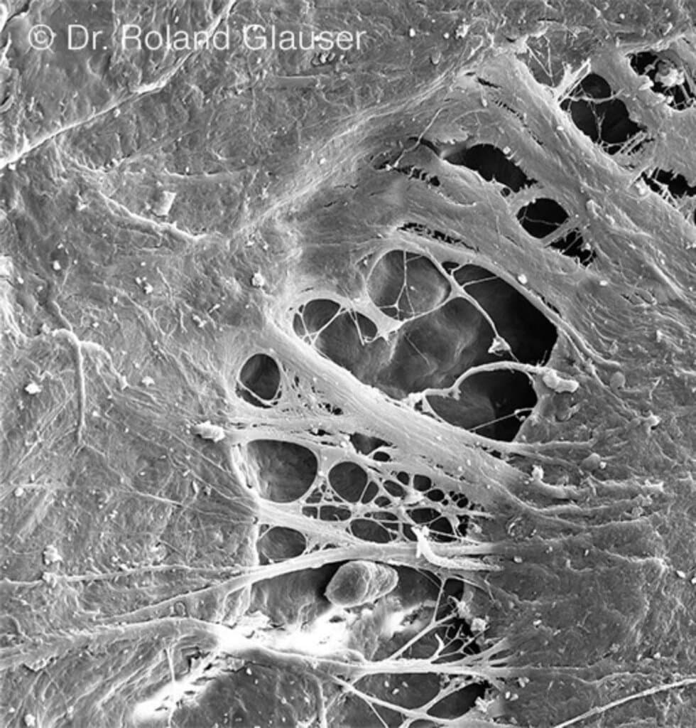 Abb2_Patent_Image20260224100124